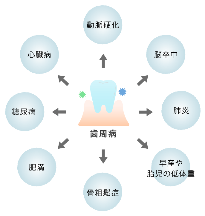 歯周病の原因